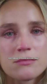 как выглядит повышенный кортизол? #стресс #рецепт #кортизол #гормон #сон #нутрициолог #живот