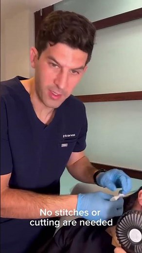 Laser Mole Removal Procedure Explained by Dr. George Kravvas | GHB Clinic London