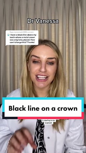 Understanding Black Line on Dental Crown: Causes and Solutions