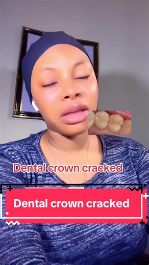 How to Handle a Cracked Dental Crown