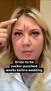 143K views · 2K reactions | A bride-to-be got sucker-punched during her bachelorette party, just four weeks before her wedding. Canada Rinaldi and her friends were heading to their AirB&B in Dallas, Texas, when Rinaldi was attacked and face-planted on the ground. She tells Inside Edition's Jim Moret she has no memory of the unprovoked assault. The unidentified suspect is still at large. | Inside Edition | Facebook