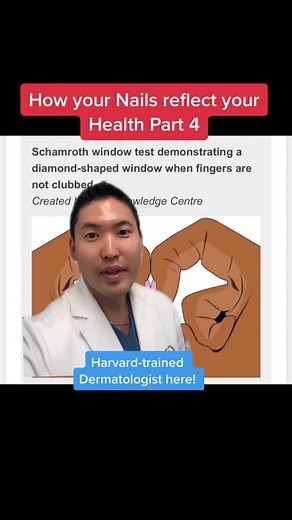 Understanding Your Health Through Your Nails: Dermatologist Explains