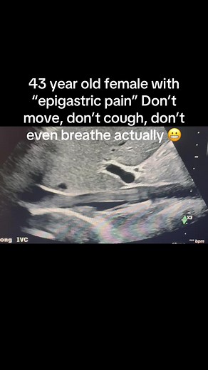 Life-Saving Ultrasound Techniques by Sonographers