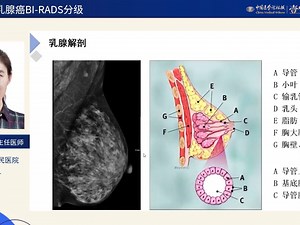 肿瘤影像1 X线乳腺癌BI-RADS分级