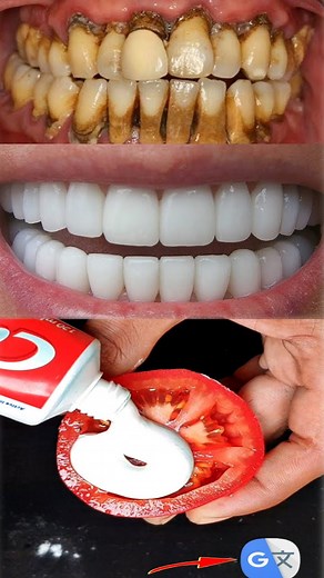 7.2K views · 85 reactions | Tomato and toothpaste for teeth whitening殺殺 teeth ## whitening## According to a Facebook post with the title “Our Pure Tips,” toothpaste, tomato pulp, and workwell to naturally whiten teeth in two. | ELEGANT BEAUTY | Facebook