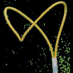 AndraTec Medical Devices | Exeter Snare (macro)