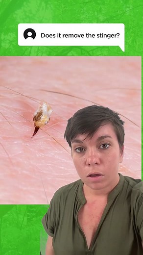 Bug Bite Thing Stinger Removal Tool | Effective Stinger Scraping & Venom Suction