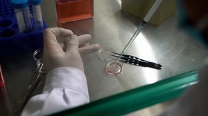 Author Spotlight: Standardizing Limbal Niche Cell (LNC) Isolation and Characterization to Support Widespread LNC Research