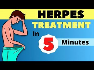 How to Treat Herpes