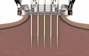 FOCUSDUAL - HIFU Skin Tightening Machine - CliniMed Aesthetics