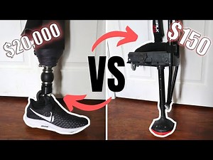 Why I Want a Prosthetic Leg ($20,000+) When an iWalk ($150) "Works"??