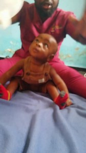 Imagine kuuza clinic kut mwana wangayu khosi lake silinalimbe mpaka lero...komanso sanakhaleko pansi moyo wake onse (9 months) Ife tinati ayi bwerani nayeni...she came with her kid unable to seat or maintain/stabilize his neck and the mama went home happy 🔥🙌🙌🙌 u wanna know how many days this was done? Mhu active eh🙌 Swe Mah | Active life rehabilitation children's foundation