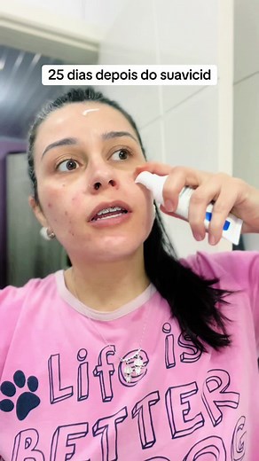 Desafio de 25 dias usando o Suavicid: Resultados e dicas de skincare