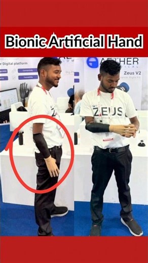 Bionic Artificial Hand #hand #naklihath #bornlife #artificiallimb #prosthesis #foryou #shortvideo