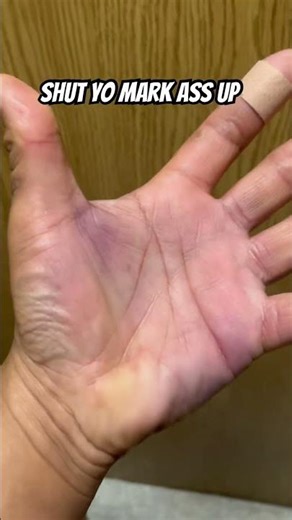 Seafood Processor Hands Destroyed 🙌 ‪@TreethaTV‬