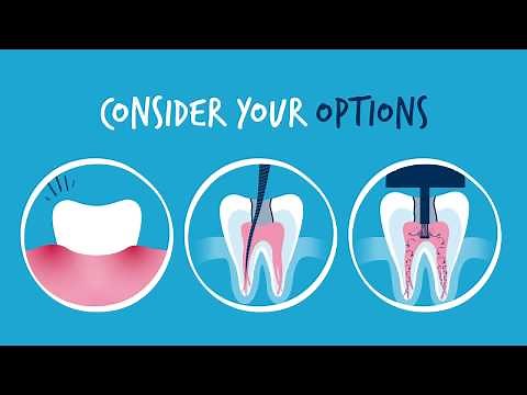 An Effective Alternative to Standard Root Canal Treatment