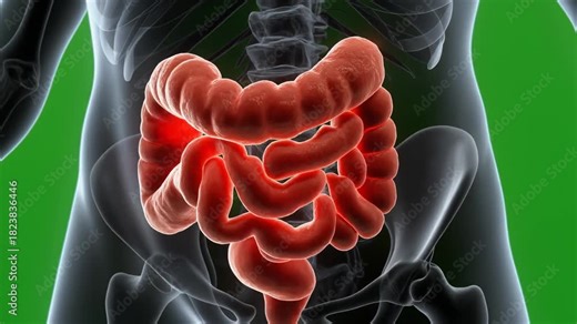 Inflamed Colon Medical Animation - Understanding Digestive Health Issues.