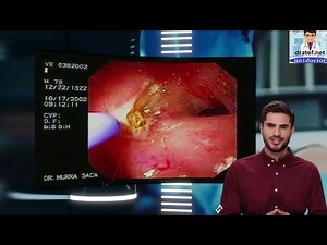 Duodenal ulcer /Peptic Ulcer Disease/GASTRIC VS DUODENAL ULCERS/endoscopy/Heart Burn /abdominal pain