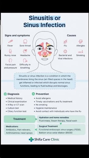 Facial Pain:(may be Sinusitis) #viral #trending #shorts #shortsfeed