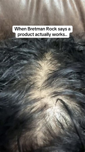 Bretman Rock's Hair Growth Journey: Discover the Secret