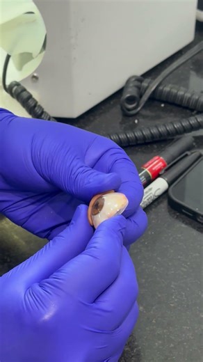 [Art Eyes] 1.6 Ocular prosthesis - Hybrid