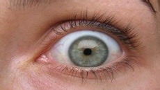 Worm invades man’s eyeball, leading doctors to suck out his eye jelly