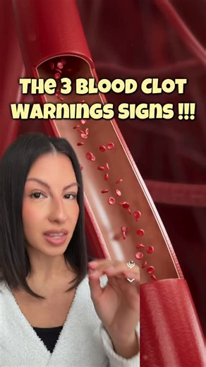 Karen Patino Ramirez on Instagram: "Comment “BLOOD PRESSURE” 👇👇 If you’re ready to get rid of your high blood pressure in 2026 ‼️ These are the 3 blood clot warning signs you must know 🤯"