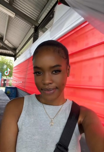 My Painful First Week with Braces Experience