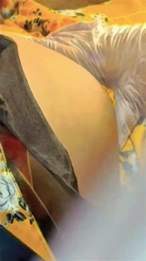 Gynaecological Examination