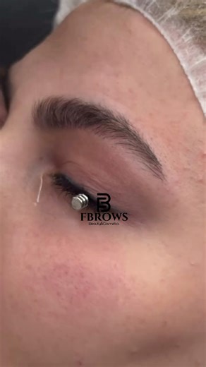 Kalıcı Makyaj Eyeliner Silme İşlemi#kalıcımakyajfatmabayhanfbrows#kalıcımakyaj#microblading#kıltekni