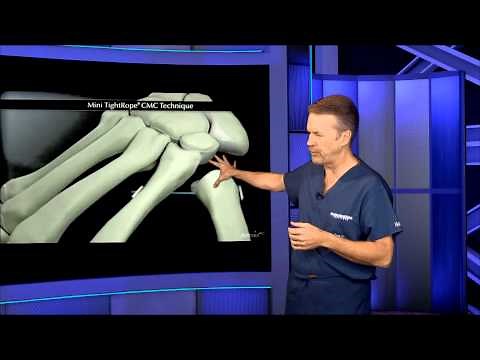 TMC Joint Replacement Surgery