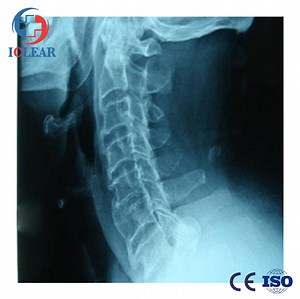[Hot Item] High-Quality Conventional Medical X-ray CT Film