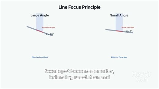 The line focus principle :X Ray imaging Physics-FRCR | Dr. Eslam Kamal
