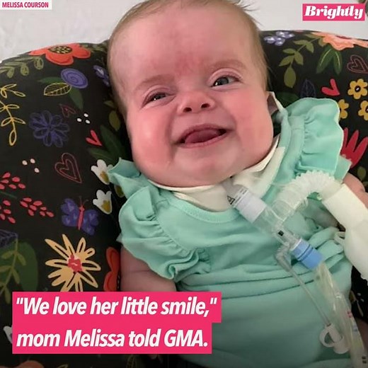 Baby with rare dwarfism goes home after 184 days in hospital l GMA Digital