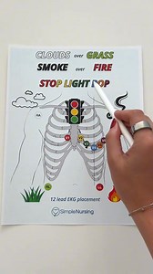 You won't forget the placements for a 12 - lead EKG with this memory trick! . . . #nursing #nurse #healthcare | Simple Nursing