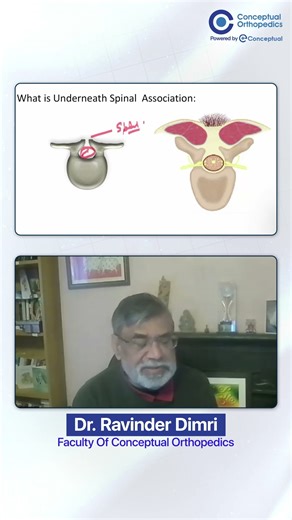 NEET SS | Spina Bifida Simplified: What Actually Causes Neurological Deficits? | Dr. Ravinder Dimri