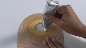 Have you tried Stomahesive® Paste yet? For additional skin protection, you can use a small amount of the paste to fill in the gaps, dips or creases between the skin barrier and your stoma. Learn more in the video! | Ostomysecrets