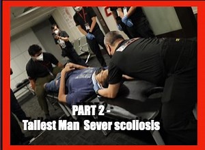 Part 2- Severe scoliosis problem due to his height, causes him great difficulty in walking. Mohd Azli Hisyam Abdul Ghafar, 24 certified as "Tallest Man" by The Malaysia Book Of Fishing Records of Records on 13/02/2013 with the height of (2.11 m)! Part 1 video ; https://fb.watch/fEfPAJ3m97/ ................................................................. Master Chris Leong Base in Malaysia Kuala Lumpur . ( 马来西亚 - 我愛 大马 吉隆坡 梁潤江 跌打師傅 )- The Star ( 2022 -09-19 ) Malaysia Kuala Lumpur Jakarta Indone