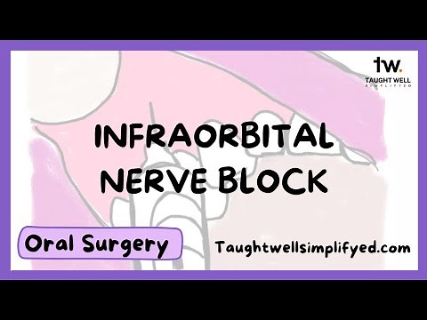Infraorbital Nerve Block Technique | Tips for finding the infraorbital foramen • Video • MEDtube.net