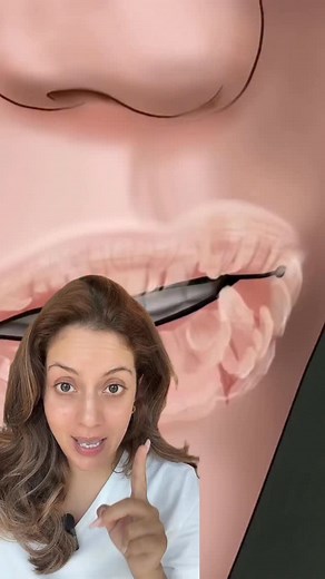 33K views · 219 reactions | A simple solution to dry cracked chapped lips. | nipunkapur | Facebook