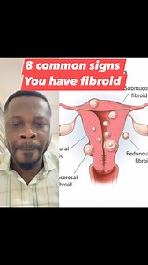 8 common signs You have fibroid | Dr. Oxford1