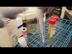 Urinalysis: Preparing the 3 patient urine specimens for microscopic analysis