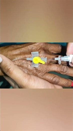 iv cannulation#hospital #youtube#youtuber #youtubeshorts #youtubeshort #vigo #emergency #icu