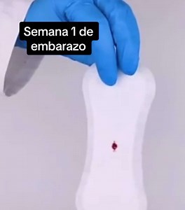Semana 1 de embarazo: Lo que necesitas saber