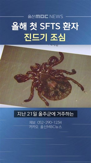 올해 첫 SFTS 환자 발생‥ 진드기 조심