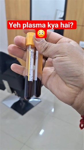 PRP Plasma Preparation 😳 | Clinic Process