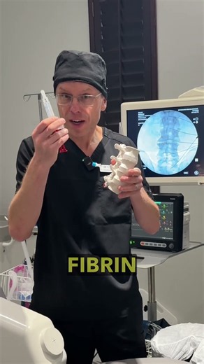How Fibrin Injections Heal Damaged Discs #spine #health