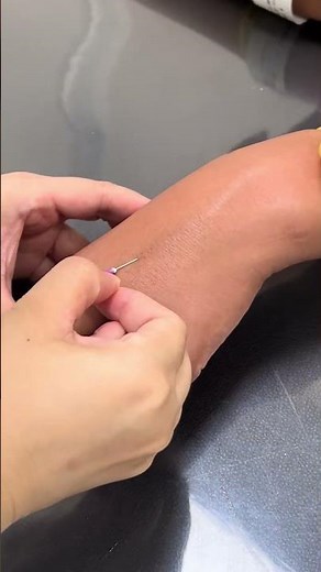 Perfect IV Insertion: Satisfying Flashback! 💉🩺 #nursing #medical