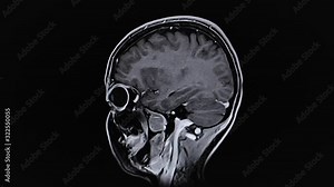 MRI brain scan,magnetic resonance imaging of a brain. Time lapse
