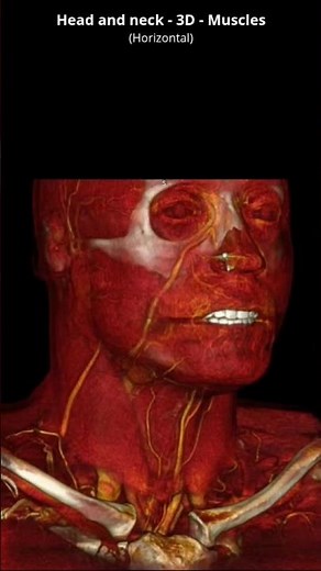 Head And neck Ct Scan MRI 3D